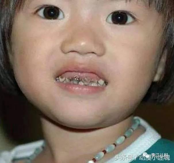 太牙在线吃瓜,揭秘娱乐圈最新吃瓜事件，带你领略明星幕后故事