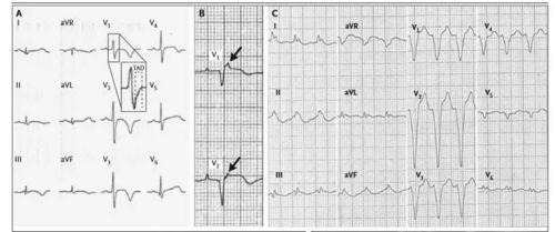 心电图泄露吃瓜群,隐私边界与网络安全的反思