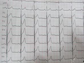 心电图泄露吃瓜群,隐私边界与网络安全的反思
