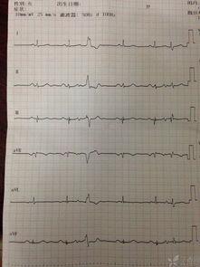 心电图泄露吃瓜群,隐私边界与网络安全的反思
